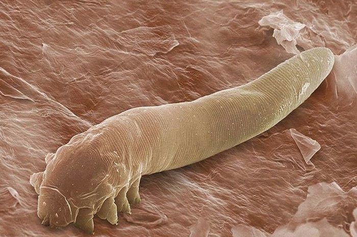 Demodex folliculorum