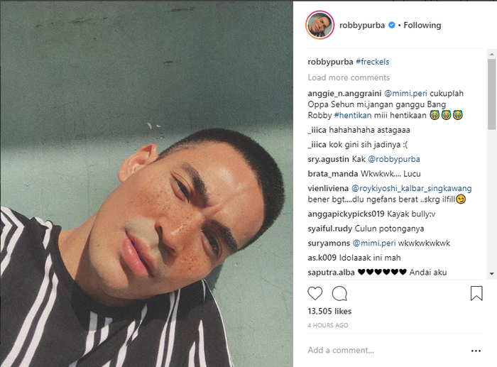 Robby Purba pamerkan wajahnya dengan makeup freckles.