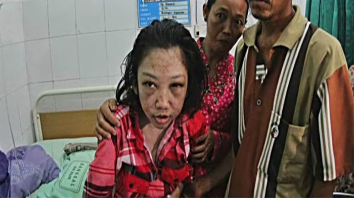 Erwiana korban penganiayaan