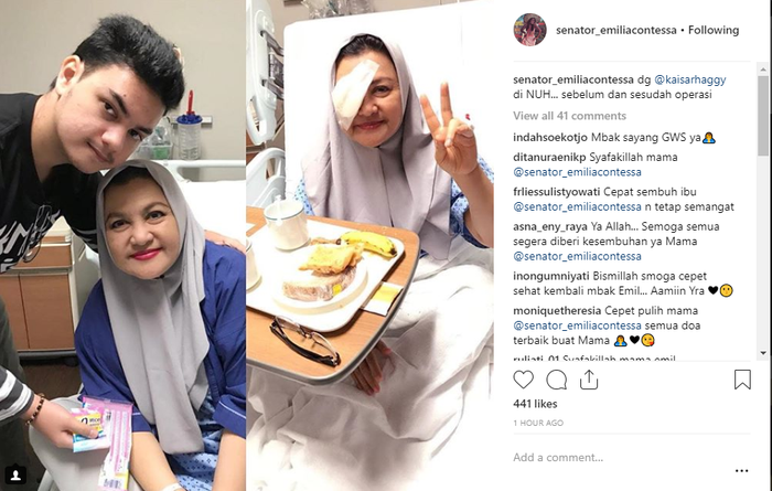 Emilia Contessa unggah foto usai operasi mata.