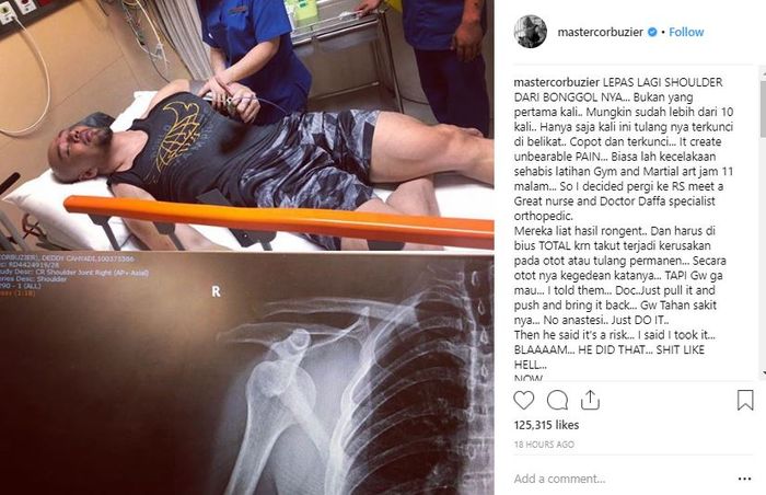 Deddy Ciorbuzier alami cidera bahu setelah berlatih bela diri