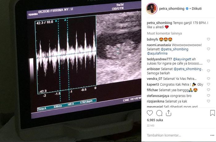 Petra mengabarkan Firrina Sinatrya hamil calon buah hati mereka.