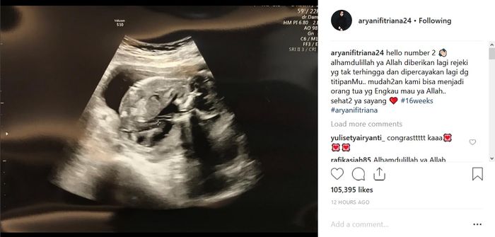 Kabar kehamilan Aryani Fitriana