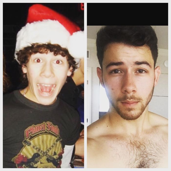 Nick Jonas Pada Saat Remaja dan Sekarang.