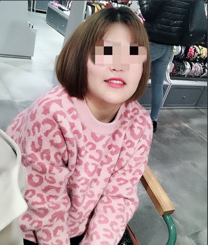 Foto Xia Lisha sebelum operasi plastik