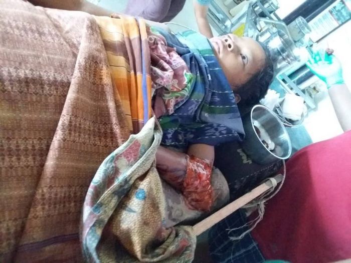 Aksi Heroik Seorang Ayah yang Gigit Kaki Buaya Untuk Selamatkan Anaknya yang Diterkam