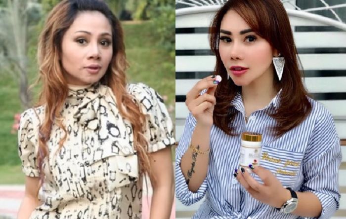 Segera Menikah dengan Pengusaha Kaya, Femmy Permatasari Blak-blakan Soal Operasi Plastik