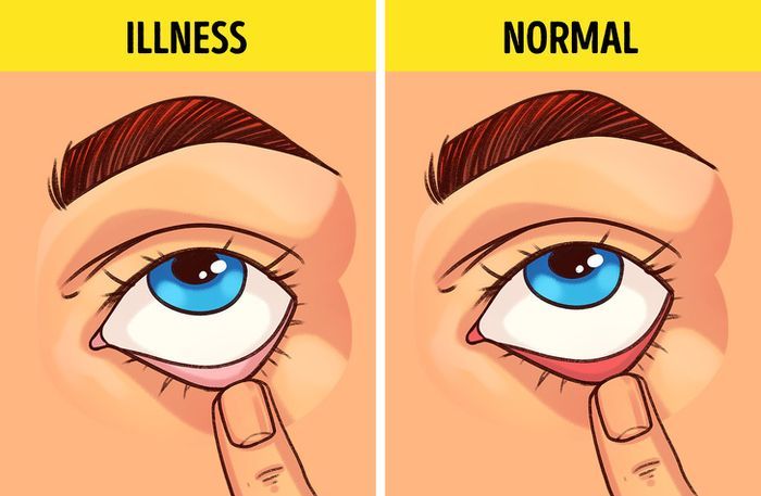 Cara melakukan tes kesehatan