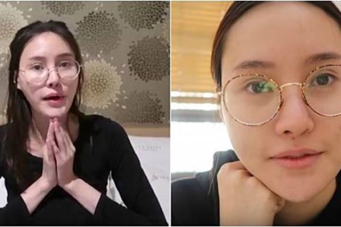 Wajah Piya sebelum di operasi