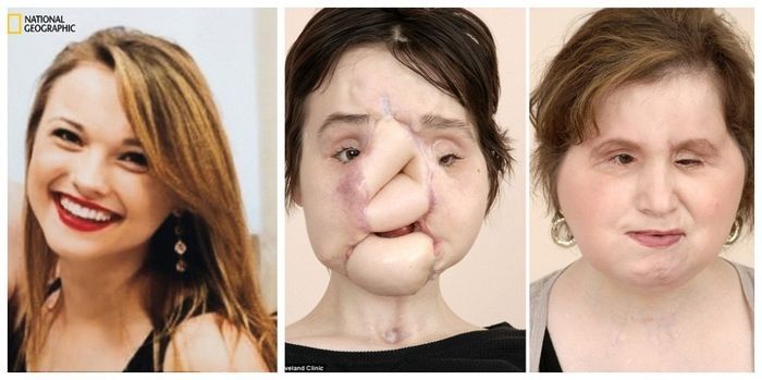 Perubahan wajah Katie Stubblefield