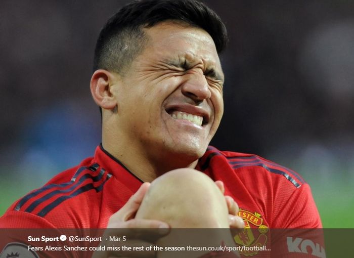 Alexis Sanchez meringis kesakitan 