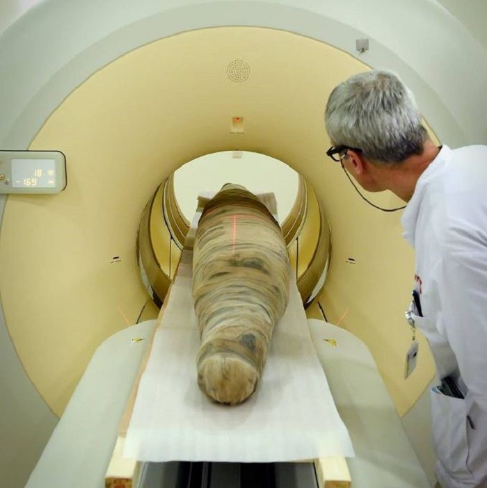 Mumi diperiksa dengan mesin CT Scan