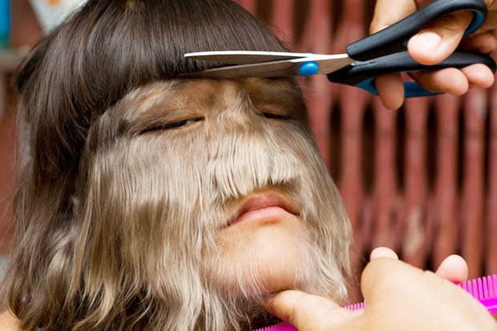 Wanita pengidap sindrom werewolf