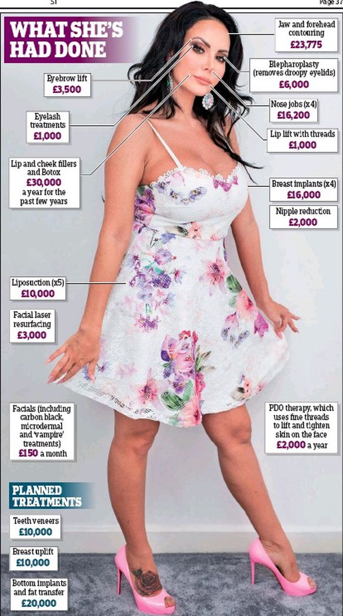 Operasi yang pernah dilakukan Star Delguidice