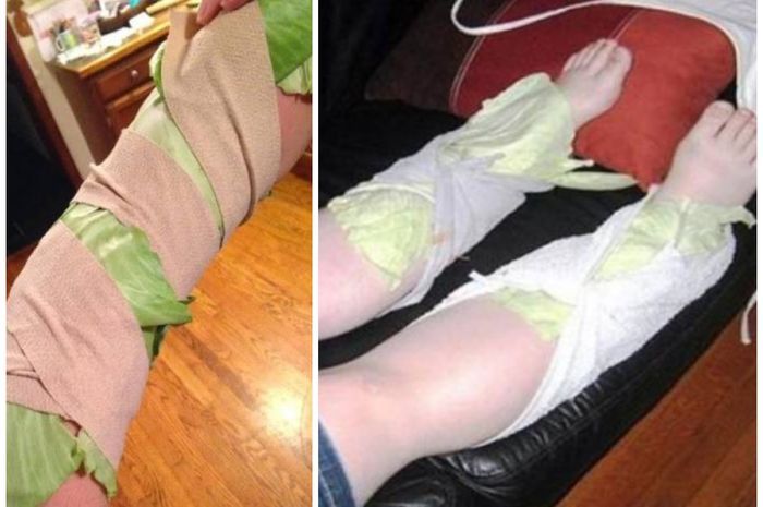 Tempelkan kubis pada tangan atau kaki