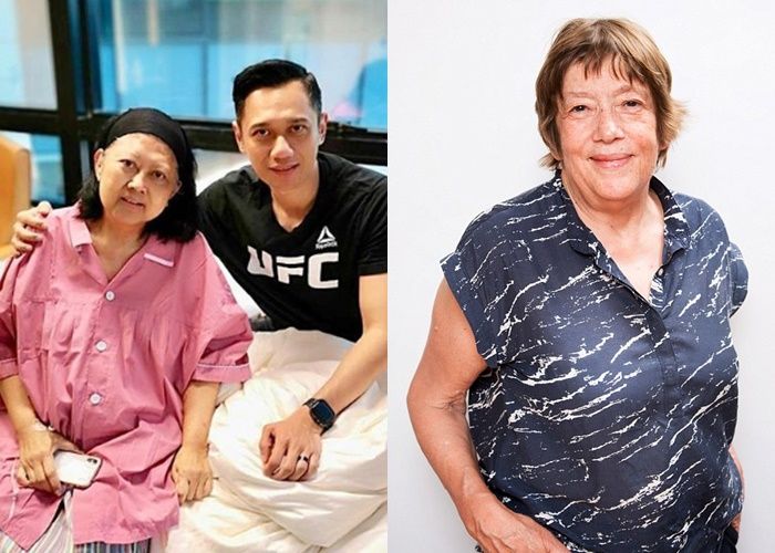 Sama Seperti Ani Yudhoyono, Wanita 69 Tahun Ini Juga Idap Leukimia, Tapi Sembuh Hanya dengan Konsumsi Kunyit!
