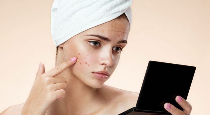 Ilustrasi wajah berjerawat