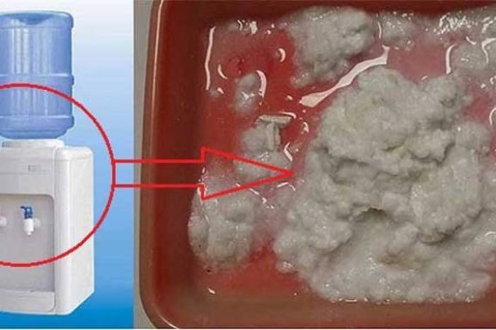 Kotoran pada dispenser