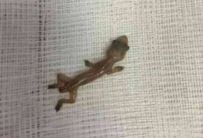 Cicak yang ditemukan di dalam telinga pasien di Bangkok, Thailand.
