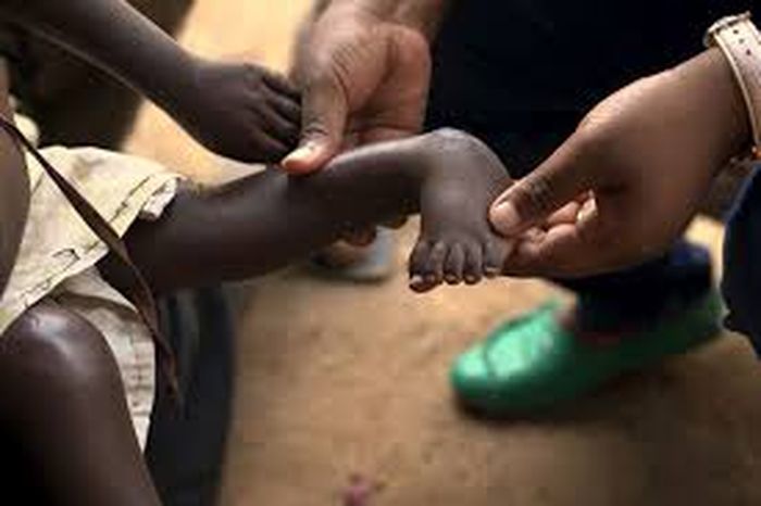 Ilustrasi pemgorbanan manusia di Uganda.