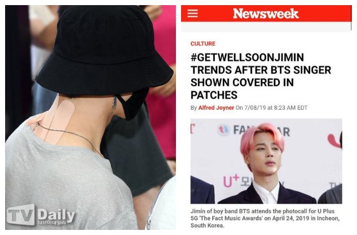 Jimin BTS saat mengenakan koyo anti nyeri.