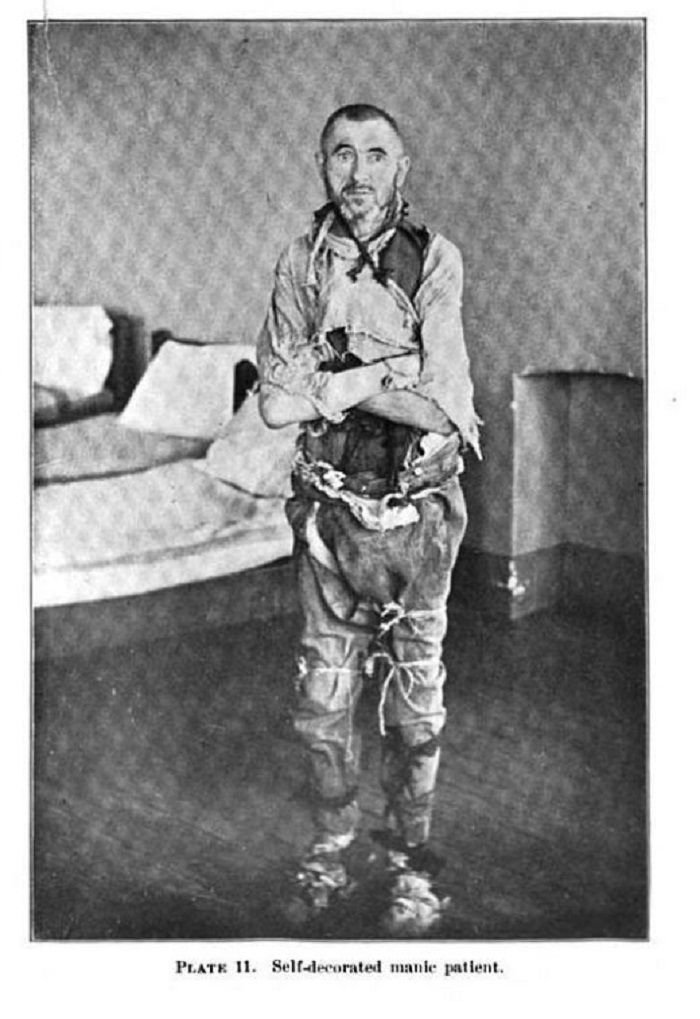 Foto mengerikan tentang kegilaan rumasakit di masa lalu