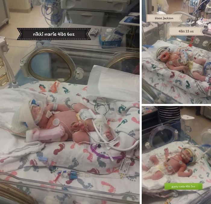 Awalnya Dikira Kena Batu Ginjal, Wanita Ini Melahirkan Kembar Tiga