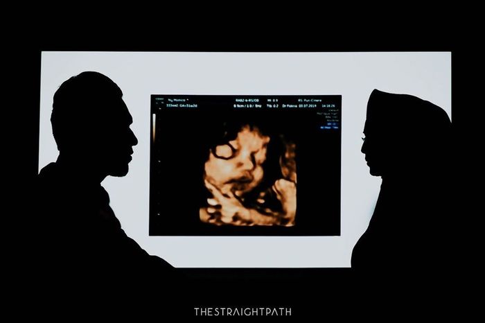 USG  putra pertama Rizal Armada dengan Monica Imas