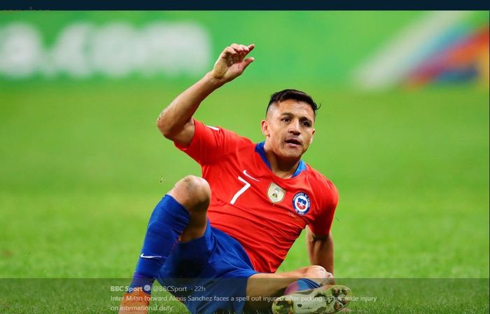 Alexis Sanchez alami cedera saat memperkuat timnas Cile.