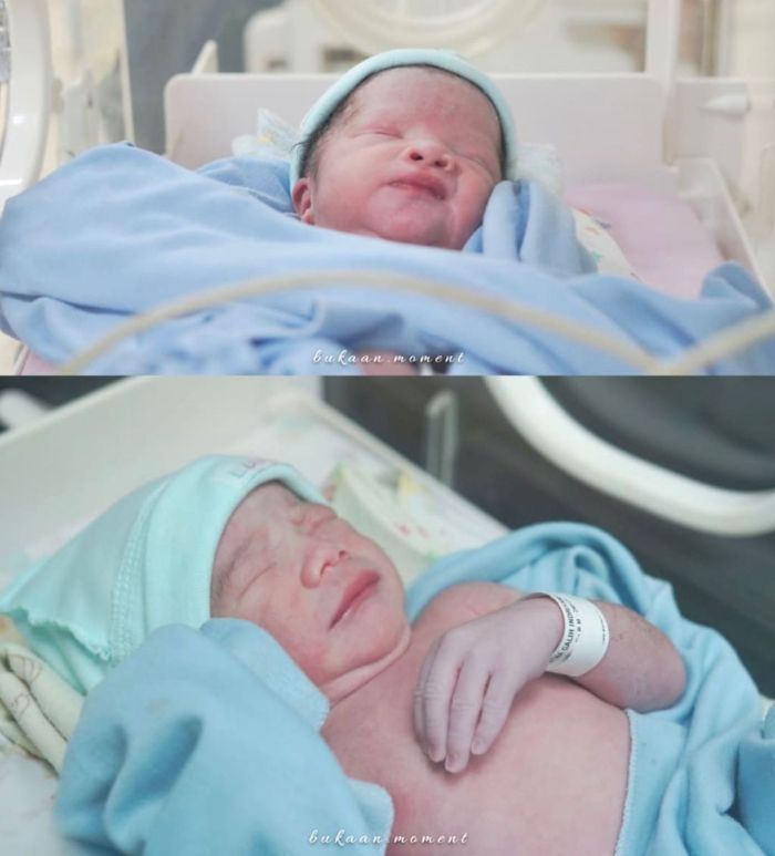 Shaldy dan Shelma, beberapa jam setelah dilahirkan.