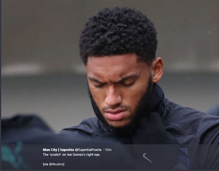 Bek tengah timnas Inggris, Joe Gomez, berlatih dengan bekas luka setelah berkelahi dengan Raheem Sterling.