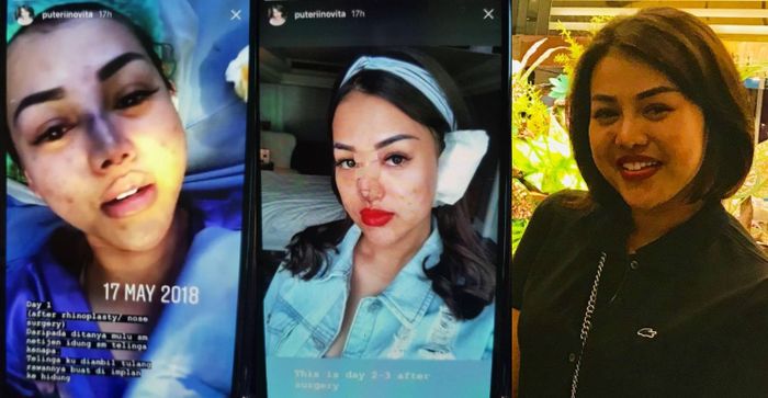 Penampilan PNR, pramugari yang diduga jadiselingkuhan Dirut Garuda Indonesia (sebelum dan sesudah oplas)