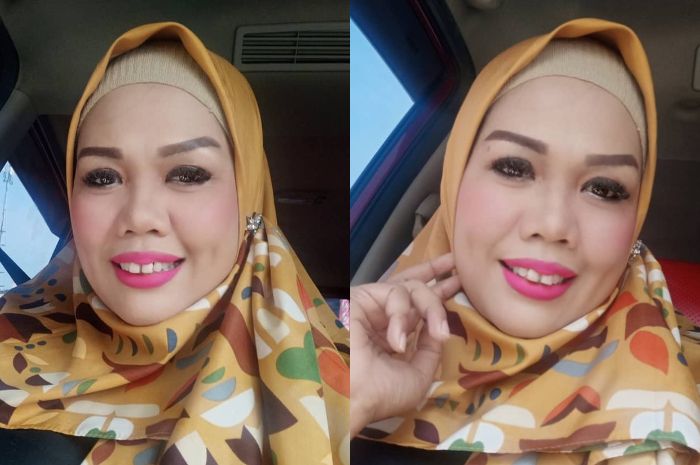 Ellu Sugigi sebelum merapikan bentuk giginya