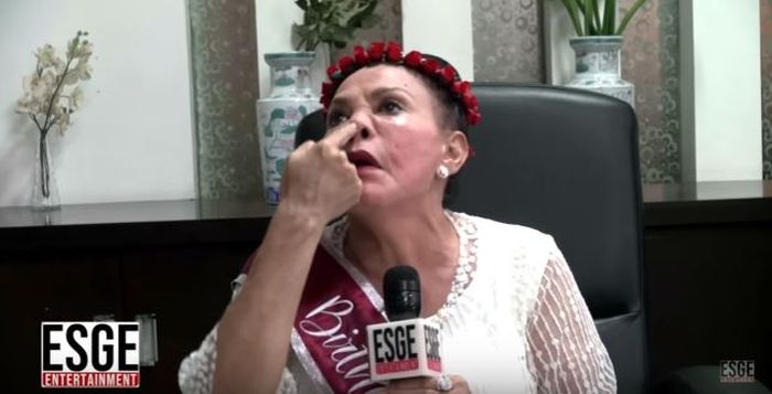 Mpok Atiek memeragakan suntik silikon yang dijalaninya