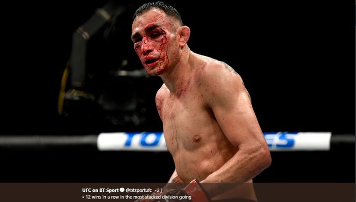 Petarung UFC asal Amerika Serikat, Tony Ferguson.