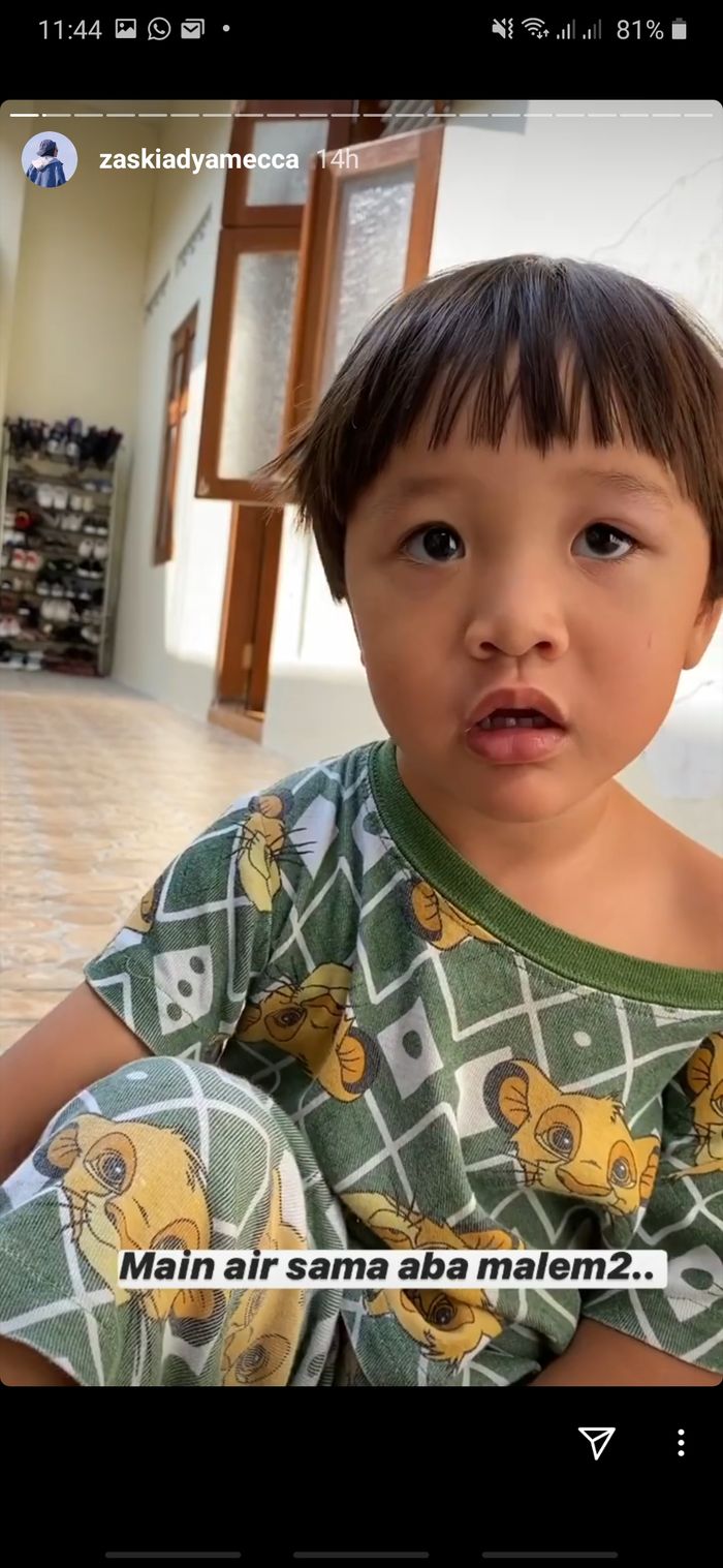 Zaskia Adya Mecca sedih melihat pelipis mata anaknya, Bhre Kata Bramantyo, bengkak