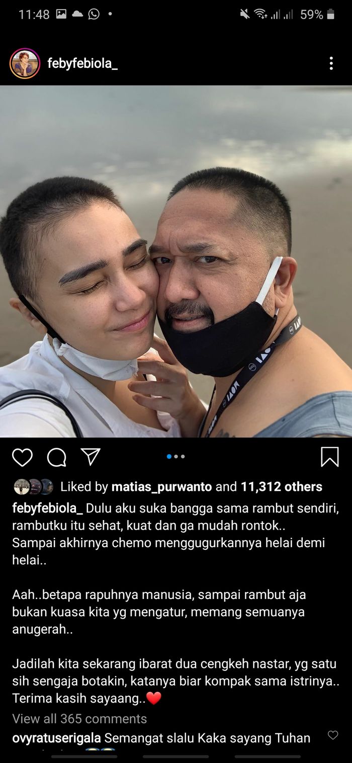 Bentuk dukungan Franky Sihombing terhadap Feby Febiola dengan mencukur rambutnya agar sama dengan sang istri.