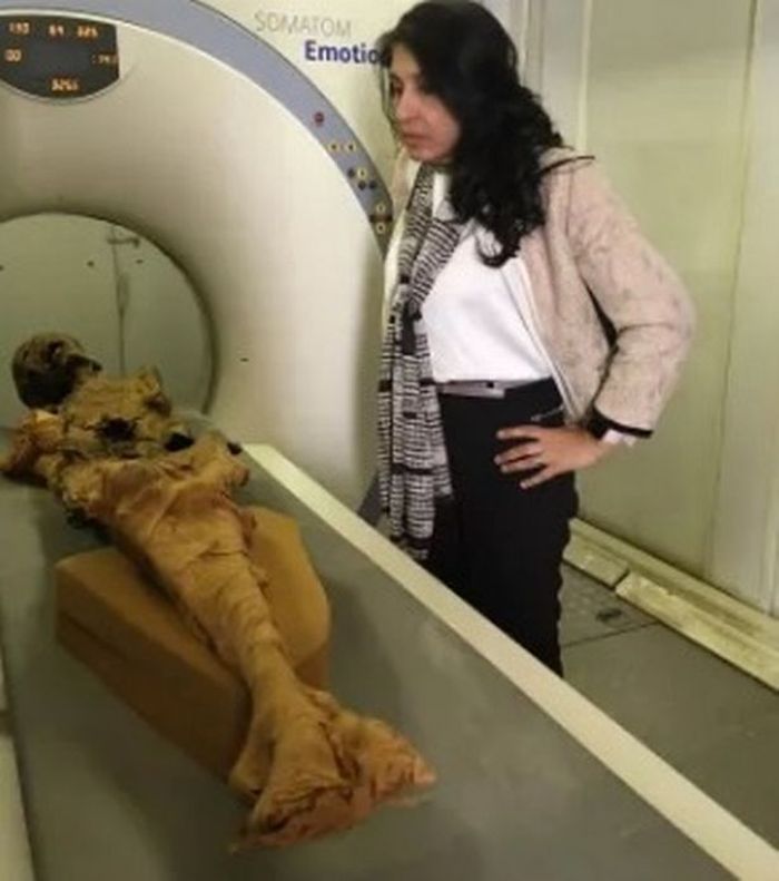 Mumi Meritamun saat menjalani CT Scan