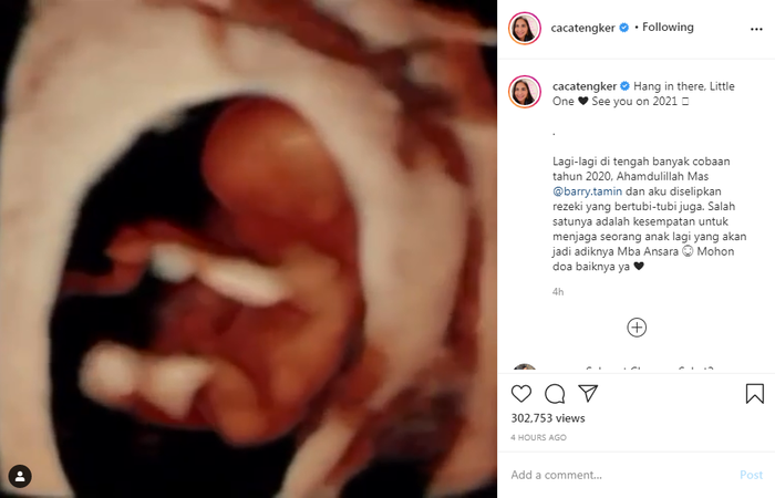 Caca Tengker umumkan hamil anak kedua.