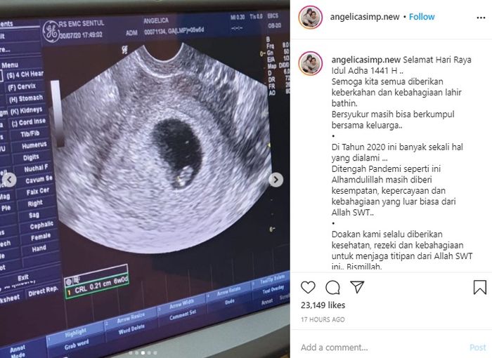 Angelica Simperler umumkan kehamilan pertamanya.