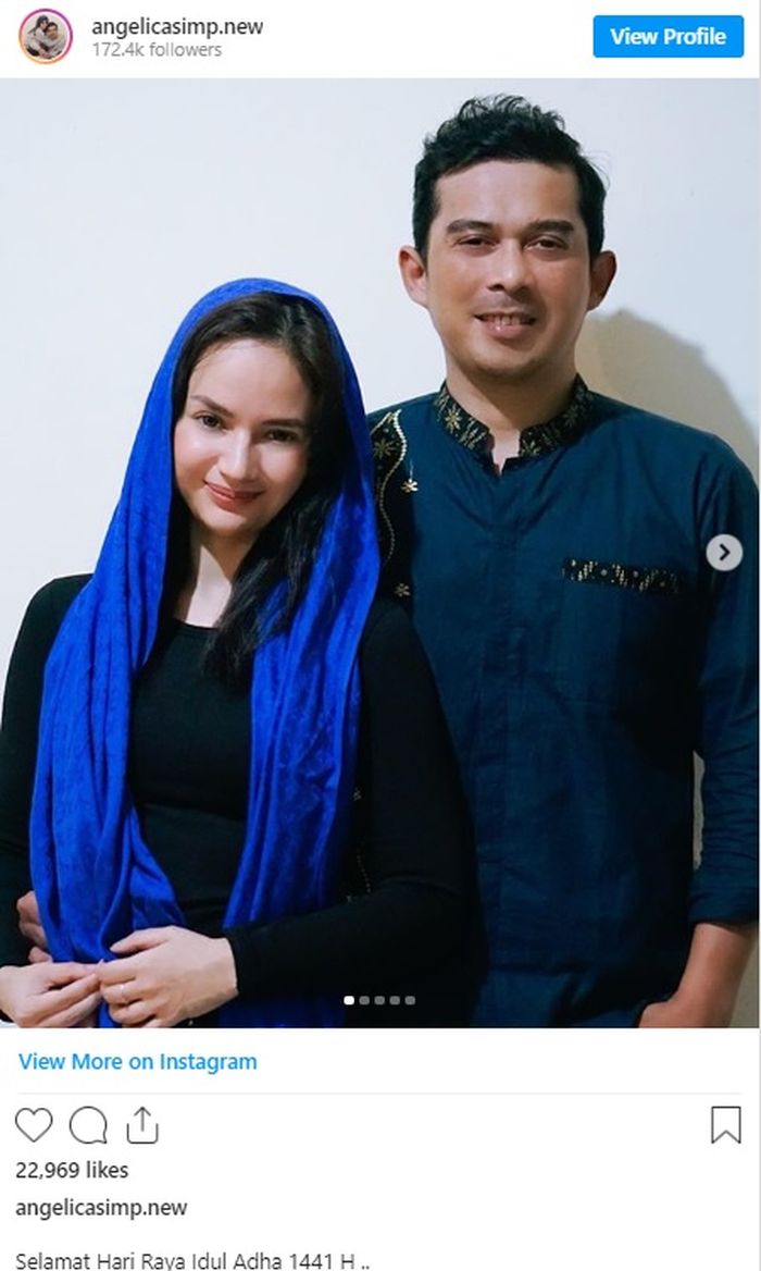 Angelica Simperler umumkan kehamilan pertamanya.