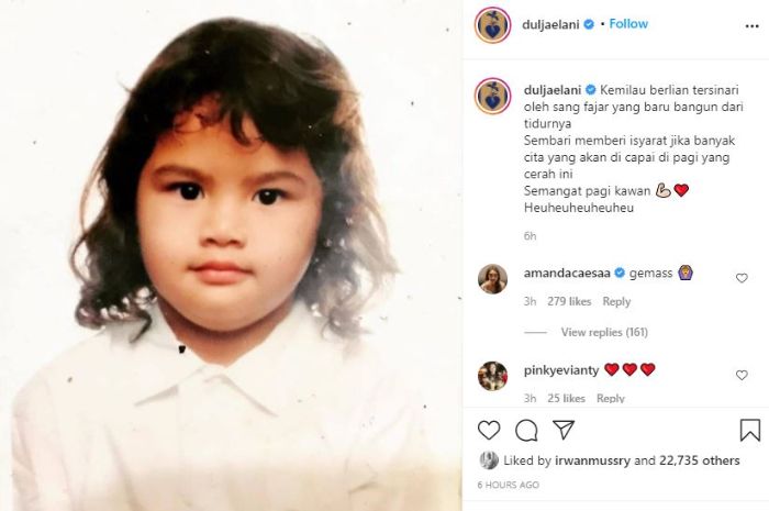 Potret jadul Dul Jaelani ketika anak-anak. 