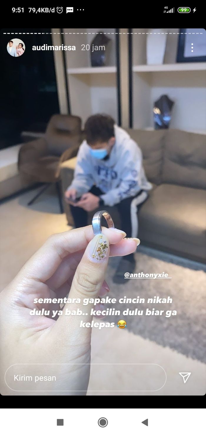 Audi memperlihatkan cincin yang seharusnya melingkari jari, kini dia pegang karena hendak dikecilkan.