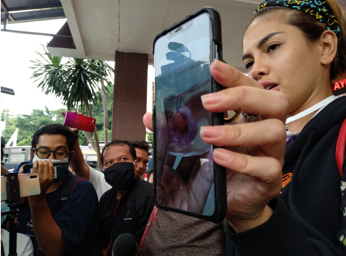 Nikita Mirzani menunjukkan usus Azka yang telah diambil, saat dijumpai Grid.ID di Polres Metro Jakarta Selatan, Rabu (14/10/2020).