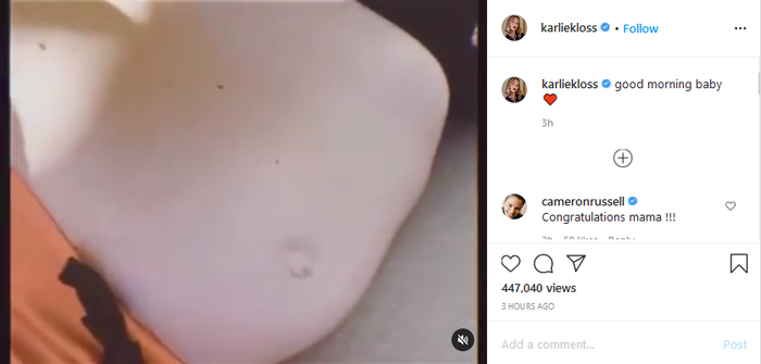 Karlie Kloss memamerkan perut buncitnya.