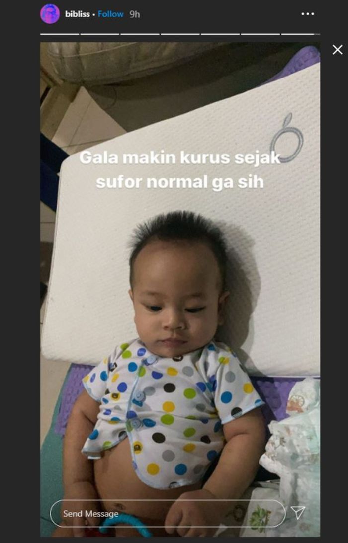 Kondisi baby Gala Sky Ardiansyah