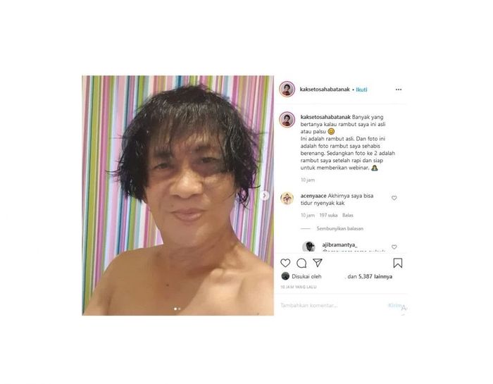 Banyak dipertanyakan, Kak Seto menegaskan bahwa ia sama sekali tak memakai wig ataupun rambut palsu