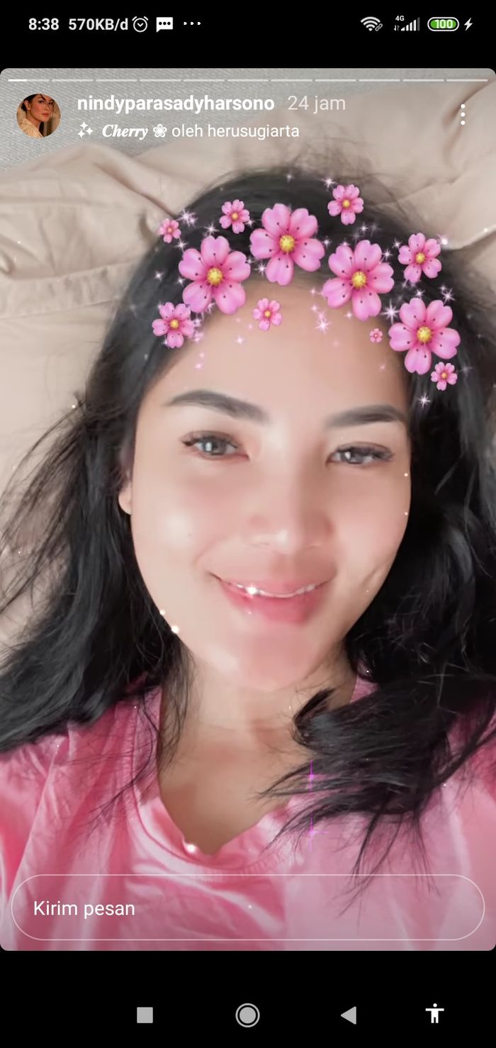 Nindy Ayunda memamerkan senyuman saat berbaring di atas ranjang.