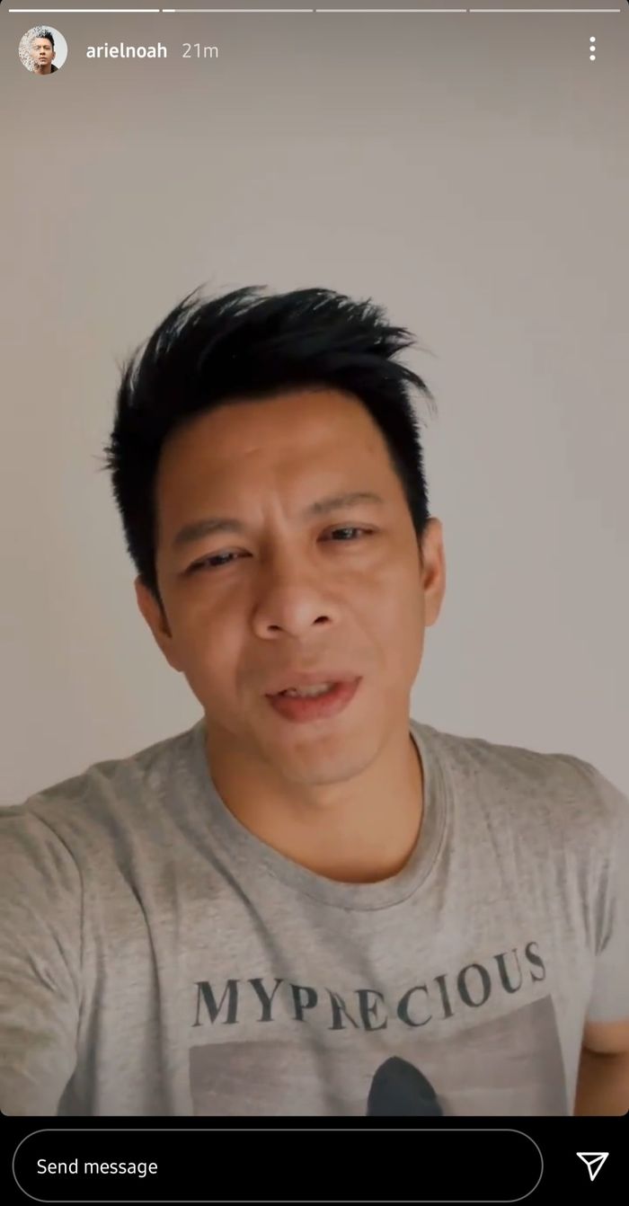 Ariel Noah ungkap perkembangan pasca menjalani suntik vaksin Covid-19 dosis kedua.