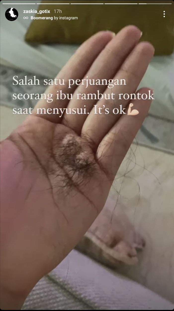 Zaskia Gotik ternyata sedang mengalami kerontokan rambut setelah melahirkan anak pertamanya pada November 2020.